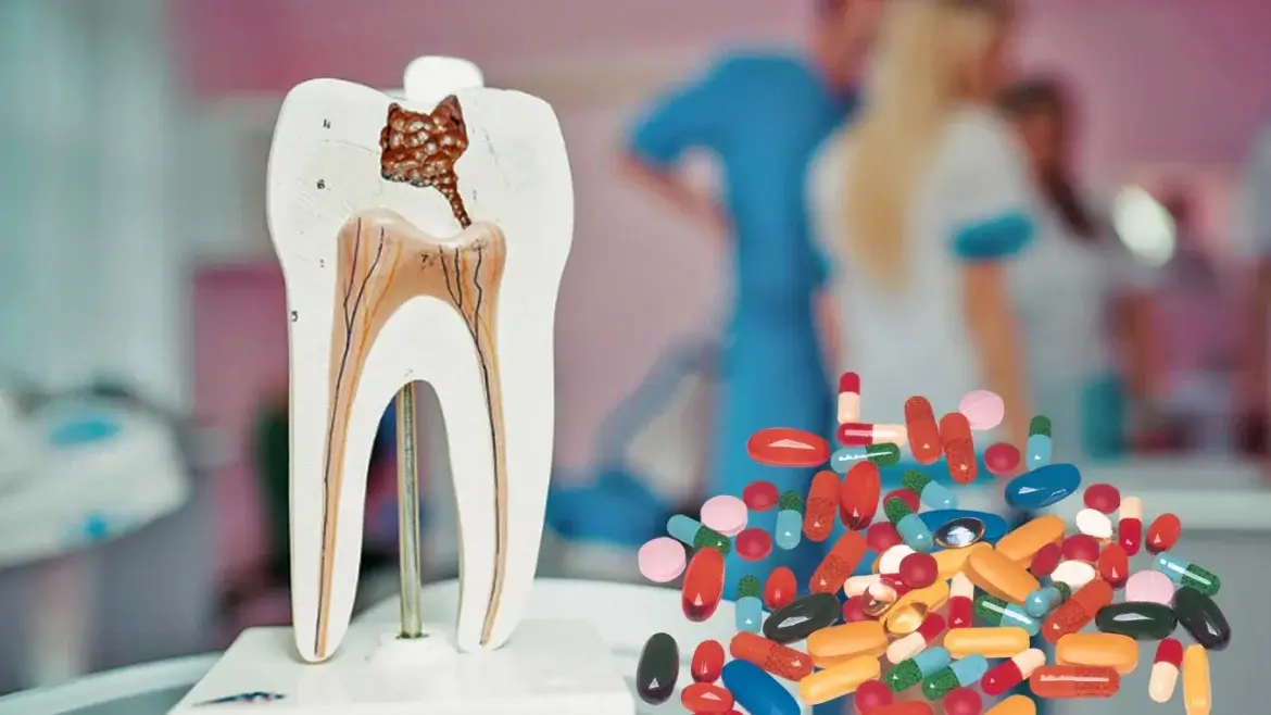 Diş İltihabı İçin Antibiyotik Tedavisi